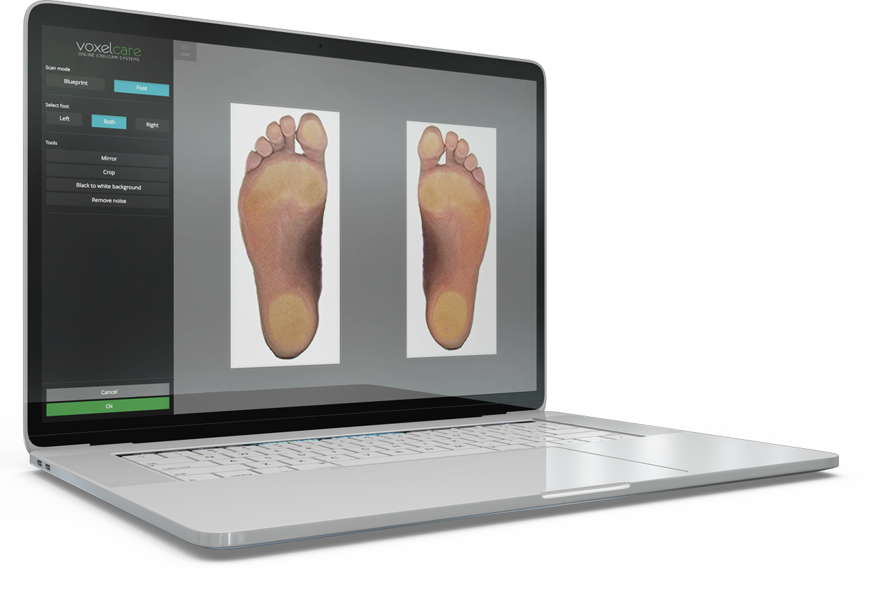 Voxelcare 2D Foot Scanner Fast and Accurate Foot Analysis