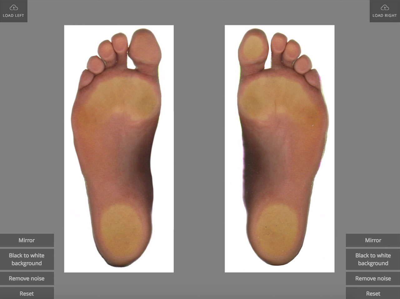 Voxelcare 2D Foot Scanner Fast and Accurate Foot Analysis